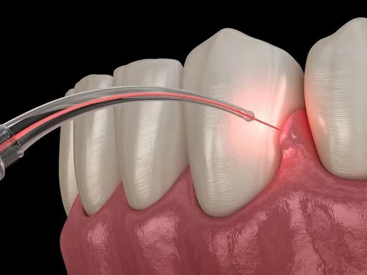 Periodontal Therapy — clinical illustration